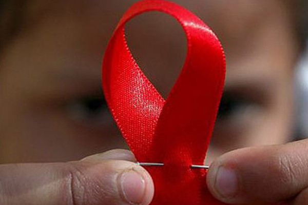 دوره واگیری و عوامل مستعد کننده بیماری ایدز